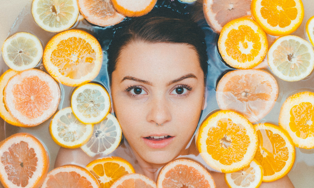 Acne: hormonaal of voedingsgerelateerd?